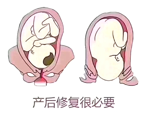 產(chǎn)后恢復(fù)項(xiàng)目好不好，兩大指標(biāo)尤為關(guān)鍵