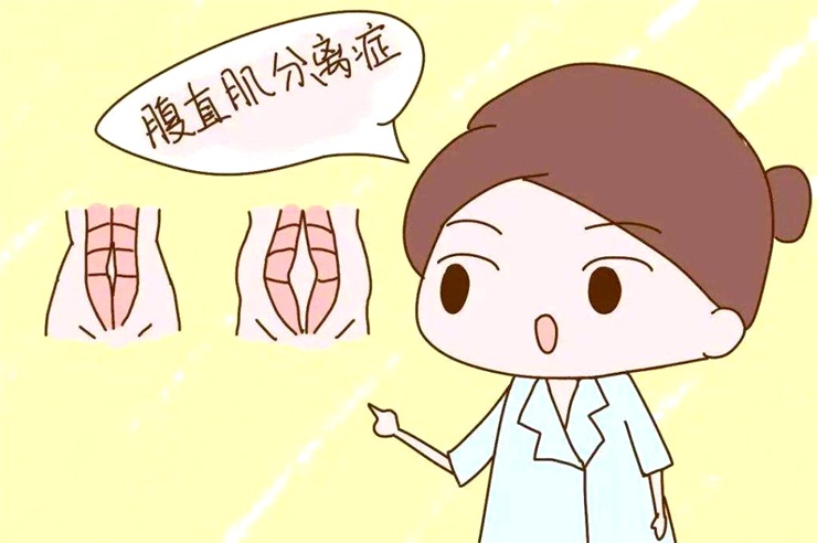 腹直肌分離問題，產(chǎn)后康復(fù)治療儀幫助您