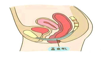盆底肌康復(fù)治療儀，如何讓盆底肌康復(fù)評估報(bào)告更可靠