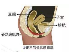 產(chǎn)后盆底肌怎么修復？你得做好盆底功能檢測