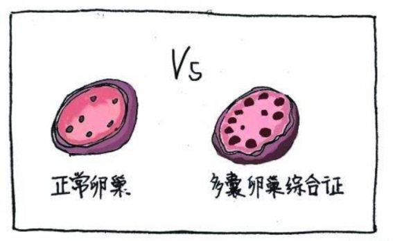 產(chǎn)后盆底肌怎么修復(fù)？盆底肌十大常見問題回答（上）