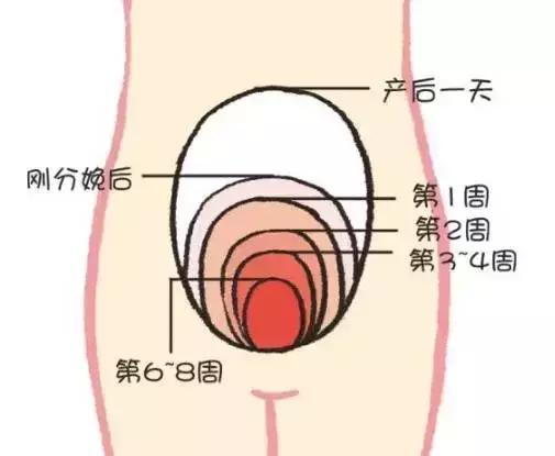 產(chǎn)后康復(fù)，什么叫子宮復(fù)舊不良？