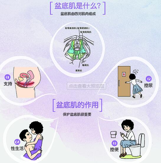 分析了1000個盆底肌治療案例，盆底功能檢測真的太重要了