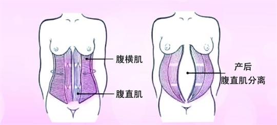 產(chǎn)后修復(fù)中心小型變大型，母乳分析儀器是專業(yè)性的體現(xiàn)