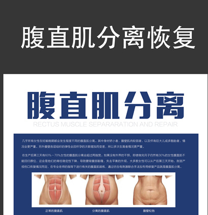 馬麗挺孕肚登春晚，孕婦還應(yīng)該知道腹直肌分離的相關(guān)知識(shí)