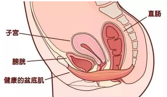 除了腹直肌修復(fù)，盆底康復(fù)也得重視，恢復(fù)好身材