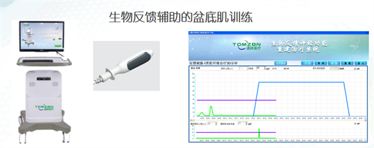 產(chǎn)后修復(fù)|盆底肌肉功能電刺激有什么作用？生物反饋呢？