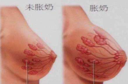 緩解漲奶，產(chǎn)后康復(fù)治療儀廠家?guī)椭a(chǎn)康門店解決乳腺疏通問題