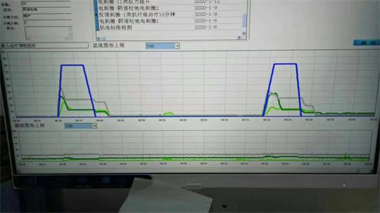 通澤子宮復(fù)舊治療儀器，痛經(jīng)不再是問題