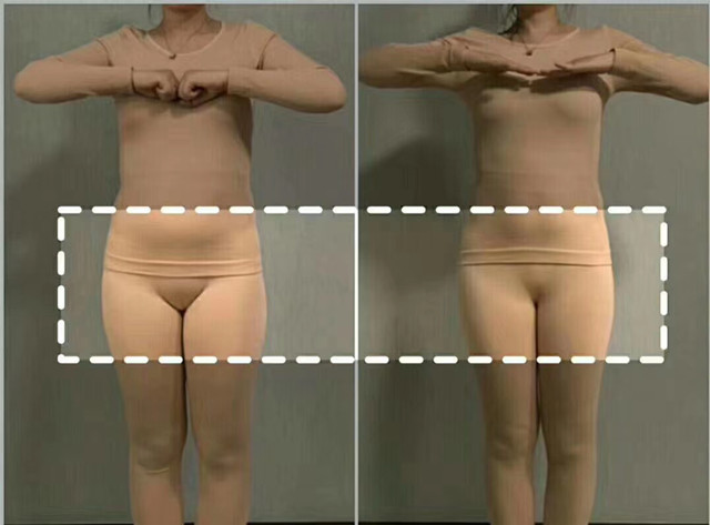 女性產(chǎn)后子宮收縮不好，會(huì)給子宮留下后患之憂，醫(yī)生媽媽建議早點(diǎn)使用子宮復(fù)舊儀
