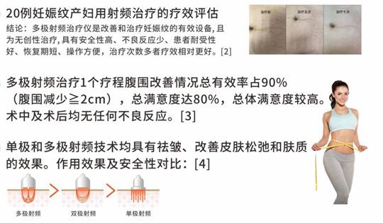 通澤產(chǎn)后塑形儀器，多極射頻破解辣媽逆齡秘訣