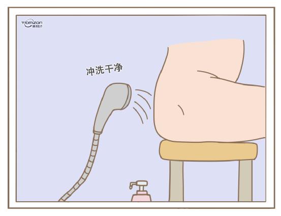     盆底恢復(fù)儀一般都是在什么時候使用？