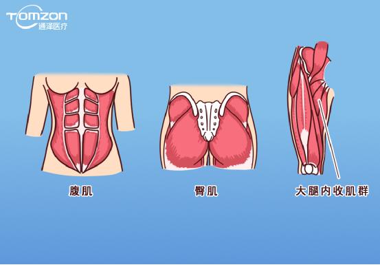 產(chǎn)后康復儀能不能改善尿失禁？
