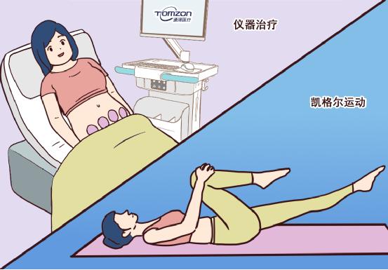 盆底肌恢復(fù)儀是一種什么樣的儀器？