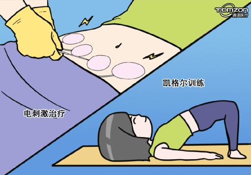 便秘的病因考慮下盆底肌，有問(wèn)題用盆底肌修復(fù)儀器治療