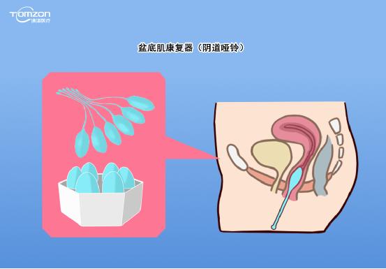 如有盆底高張者，不做力量提升型運(yùn)動，否則容易加重盆底損傷。建議在做盆底康復(fù)運(yùn)動前，先進(jìn)行盆底肌肉檢測
