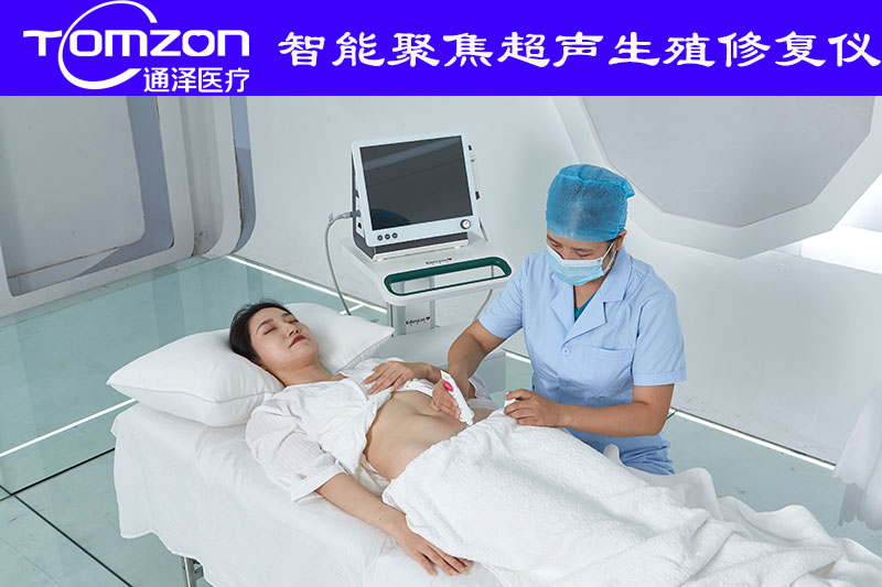 子宮復(fù)舊儀可以改善什么樣的問題？